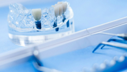 Model of an implant-supported restoration on the treatment tray