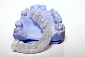 Transparent bite splint on a plaster model